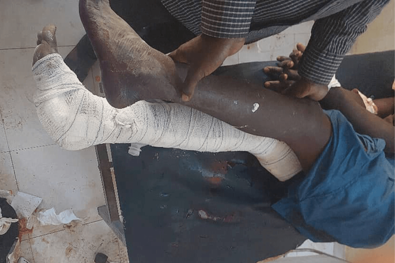 A patient is treated for a leg injury in Sudan.